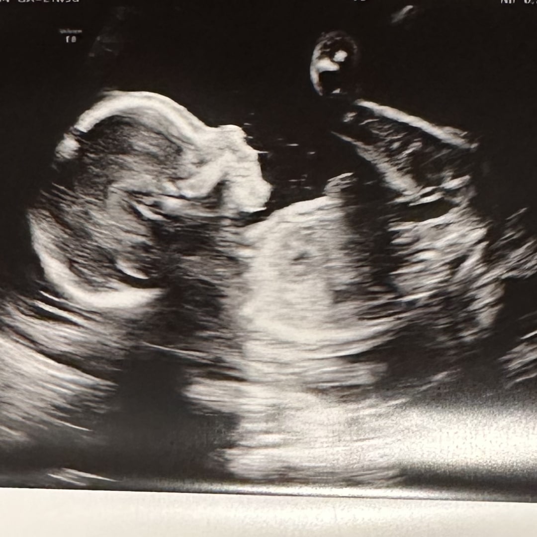Photo shared by KellyAnn for their Babylist baby registry.