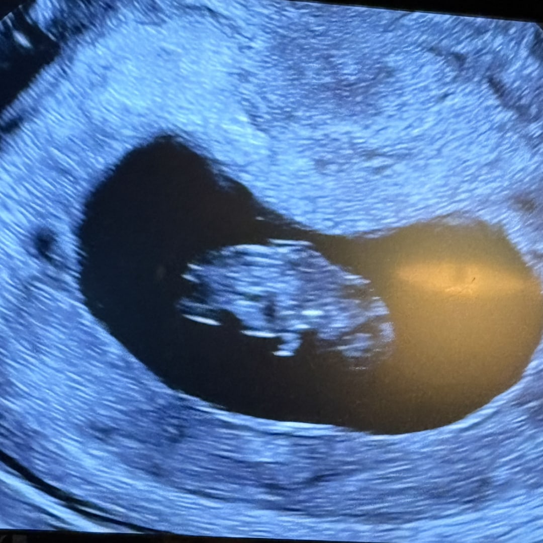 Photo shared by BRITTANY for their Babylist baby registry.