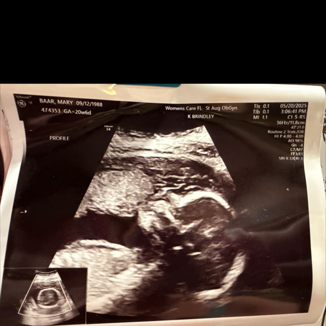 Photo shared by Caty for their Babylist baby registry.