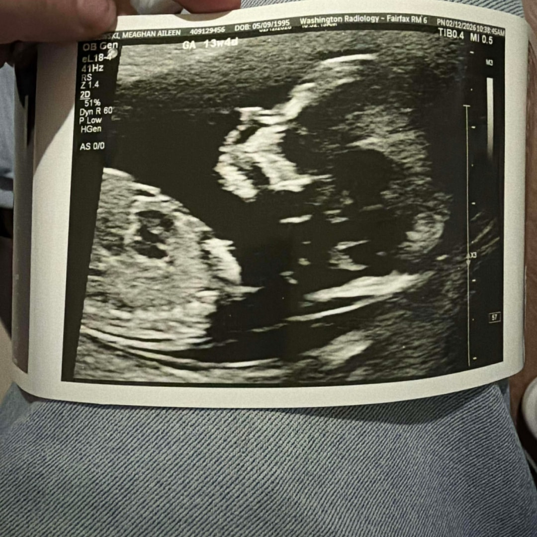 Photo shared by Meaghan for their Babylist baby registry.