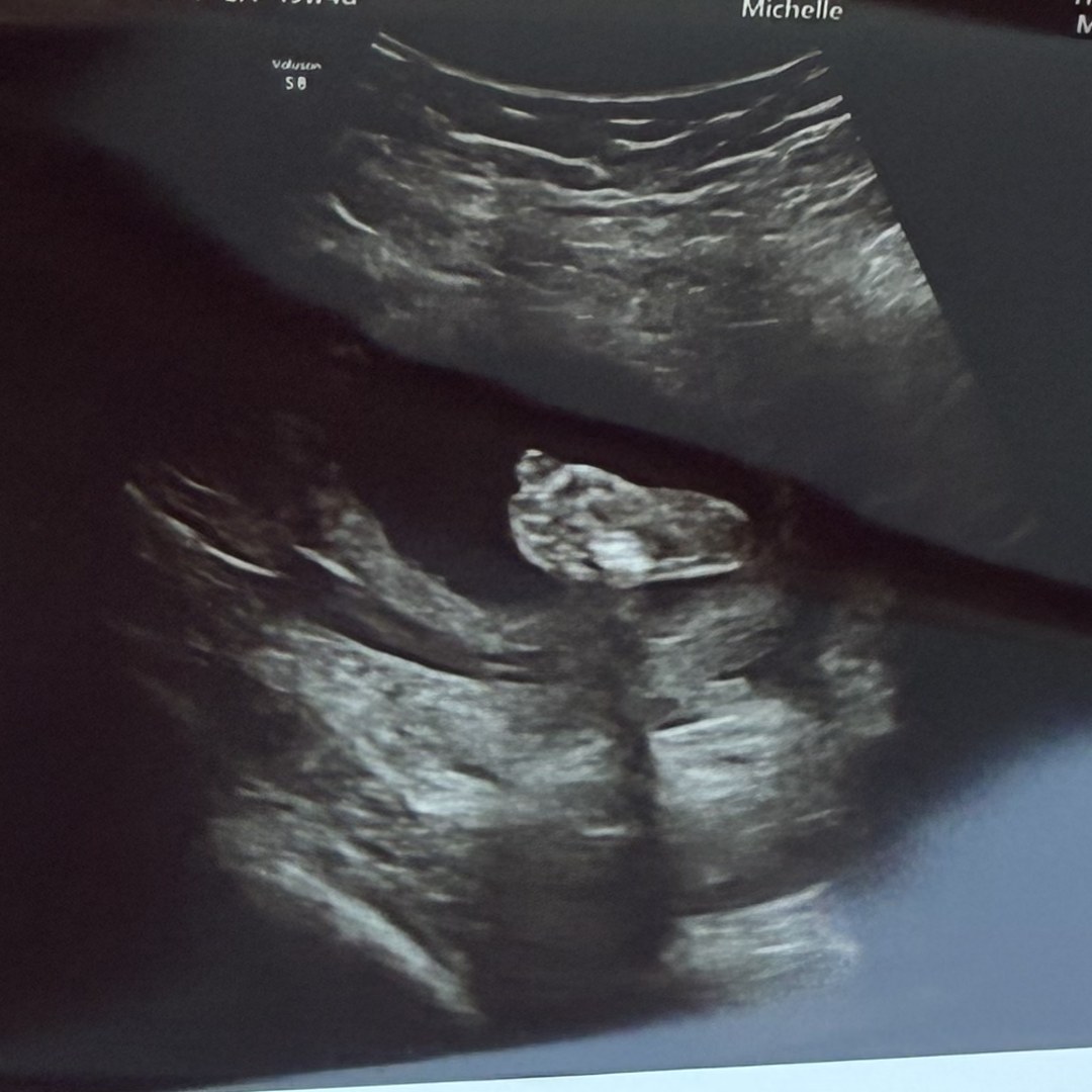 Photo shared by Amber for their Babylist baby registry.