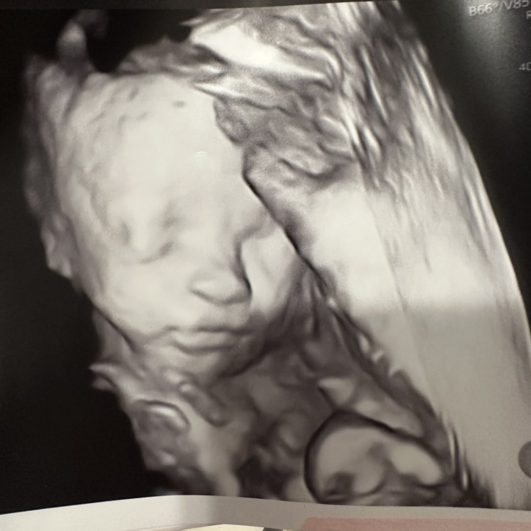 Photo shared by Mallory for their Babylist baby registry.