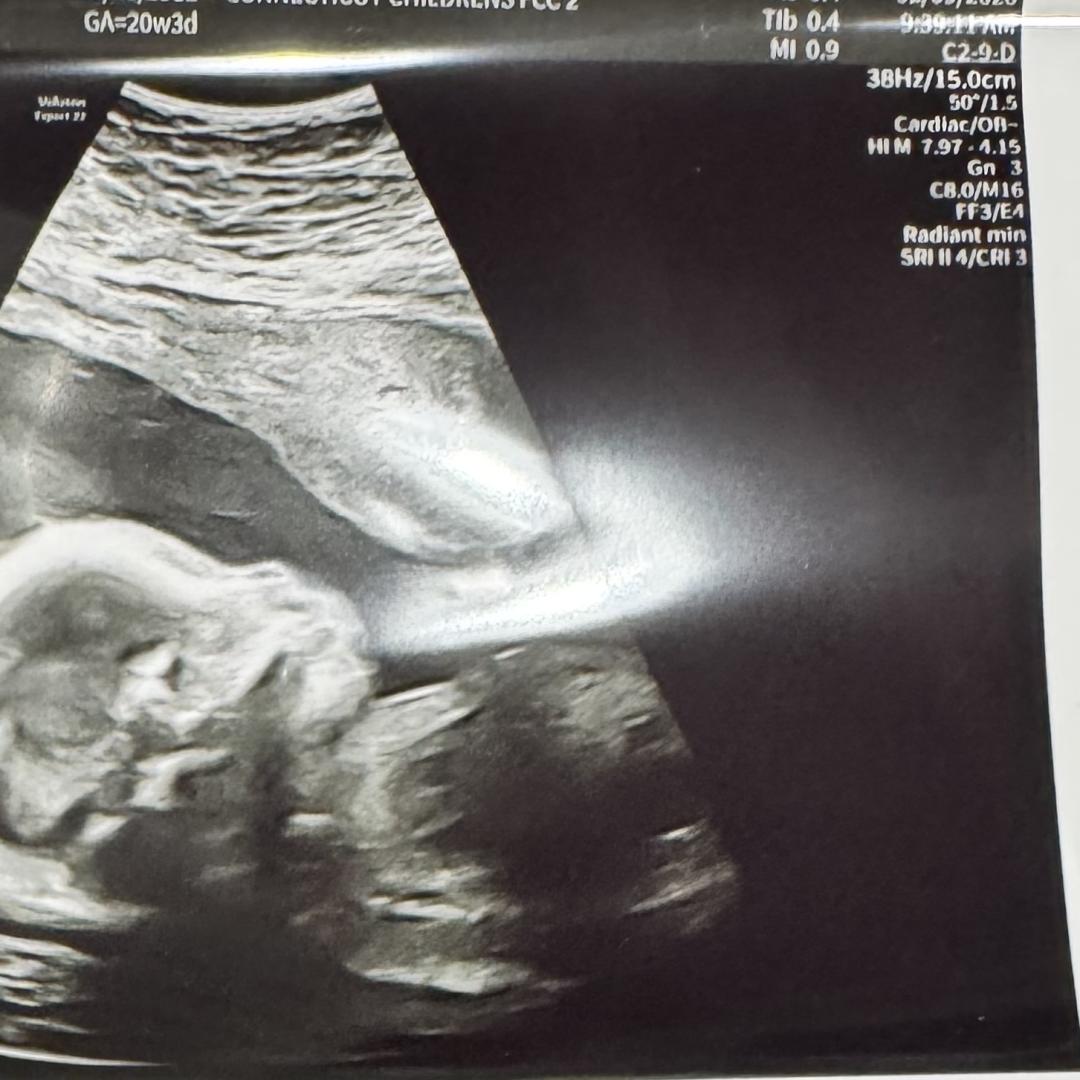 Photo shared by Ashle for their Babylist baby registry.