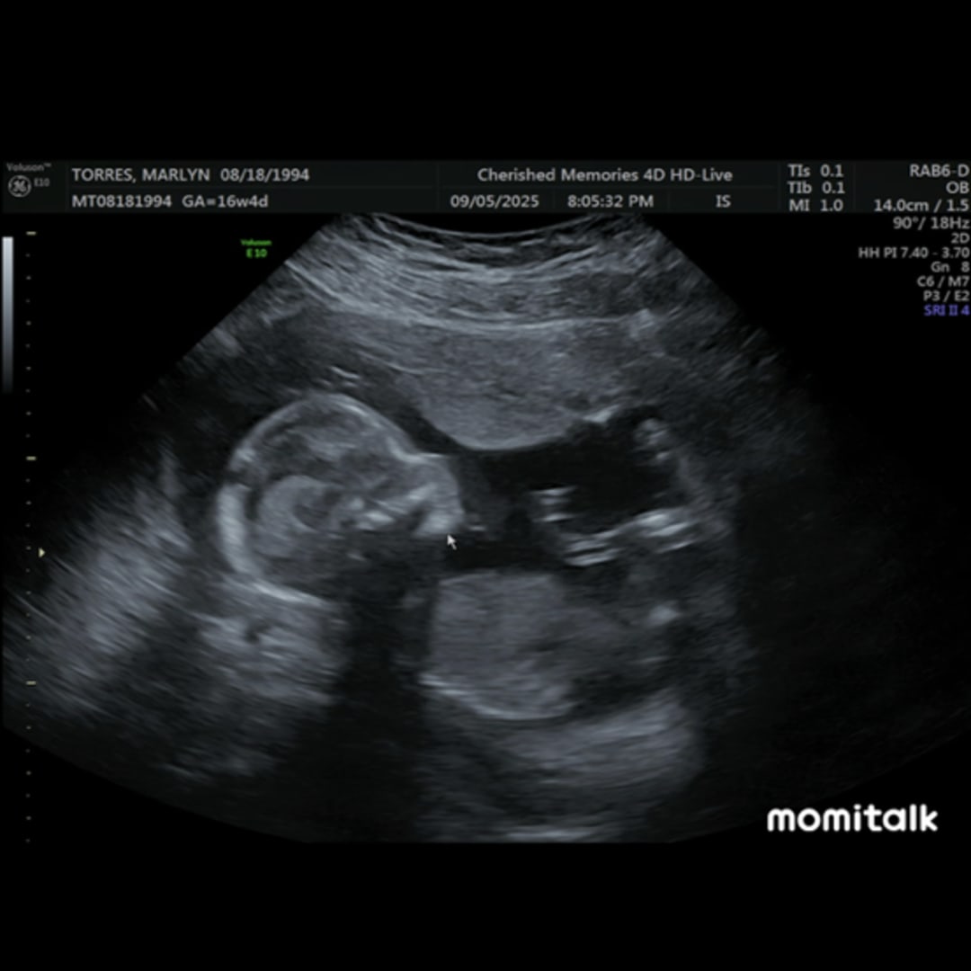 Photo shared by Marlyn for their Babylist baby registry.