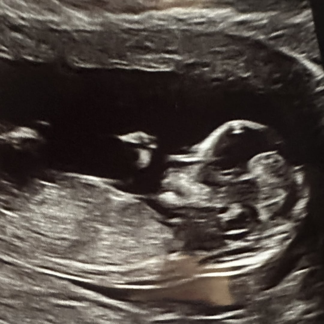 Photo shared by Allison for their Babylist baby registry.