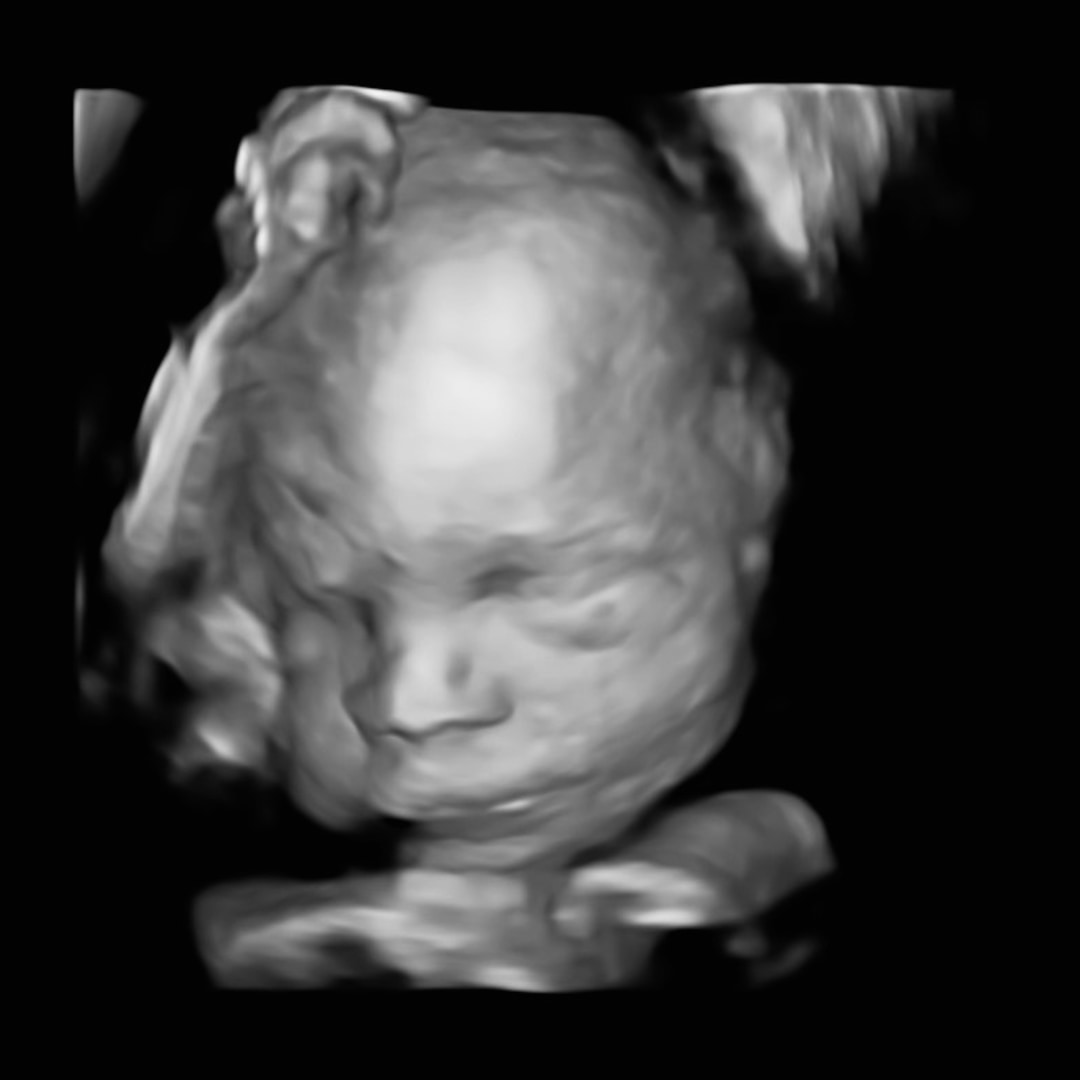 Photo shared by Annastasia for their Babylist baby registry.