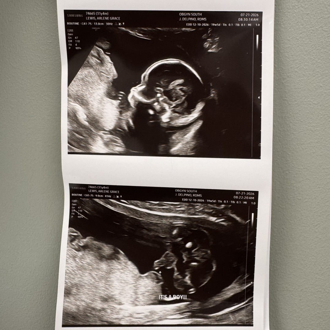 Photo shared by Arlene Grace for their Babylist baby registry.