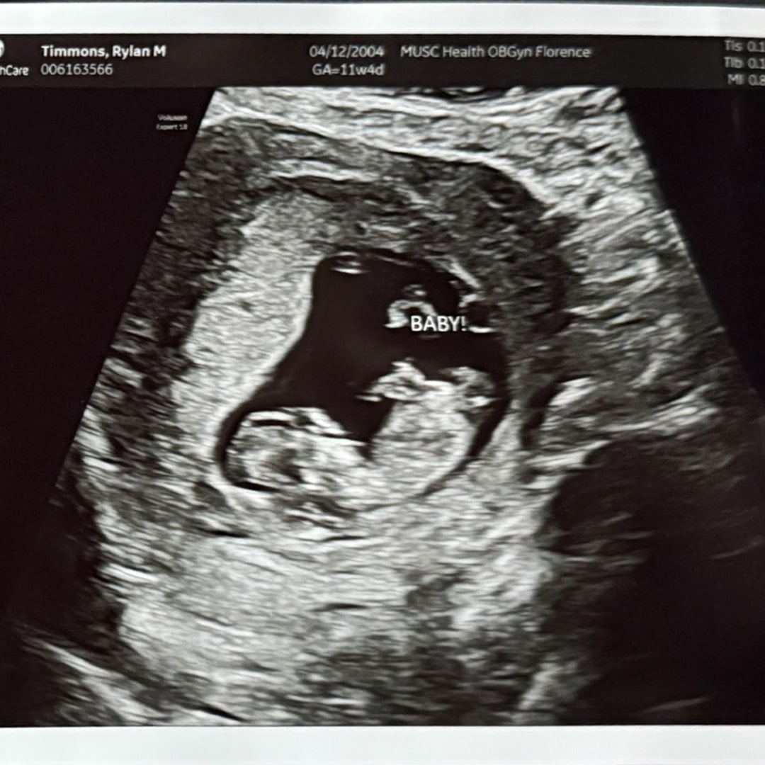 Photo shared by Alex for their Babylist baby registry.