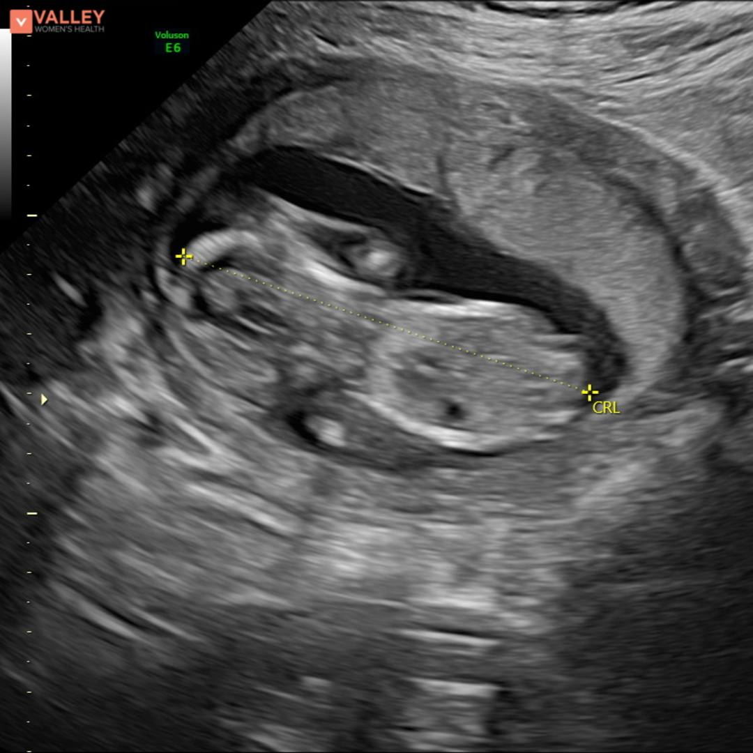 Photo shared by Jenessa for their Babylist baby registry.