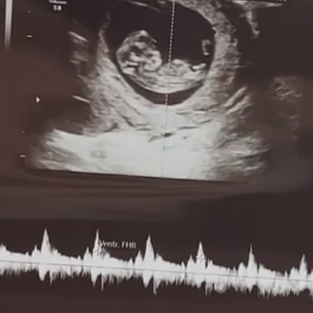 Photo shared by Paige for their Babylist baby registry.