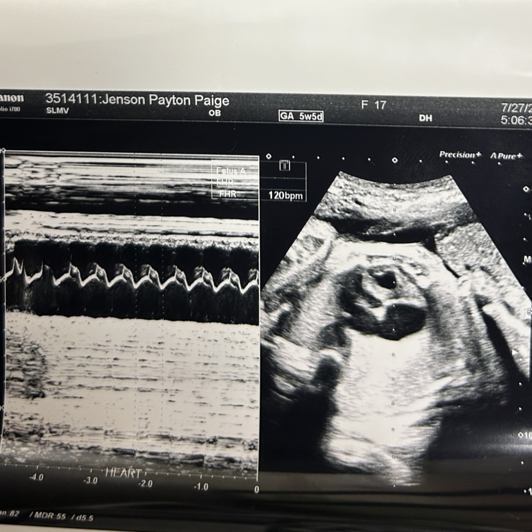 Photo shared by Payton for their Babylist baby registry.
