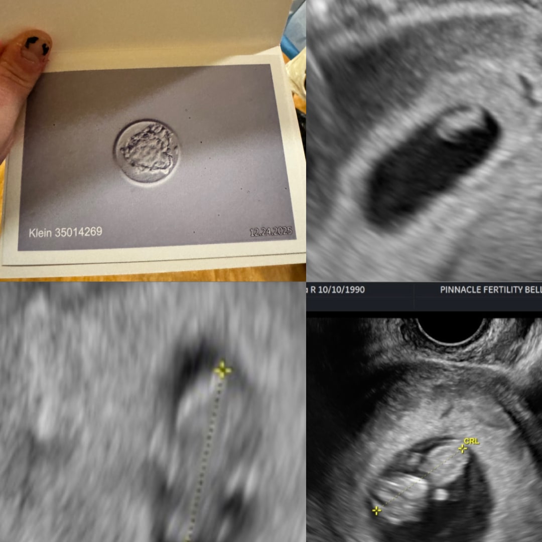 Photo shared by Rebecca for their Babylist baby registry.