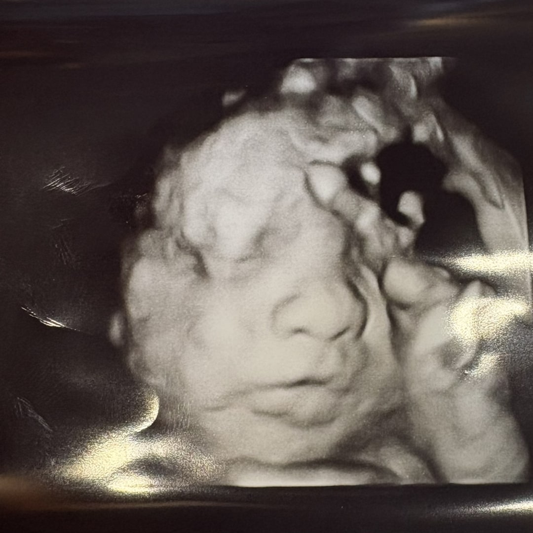 Photo shared by Kiara for their Babylist baby registry.