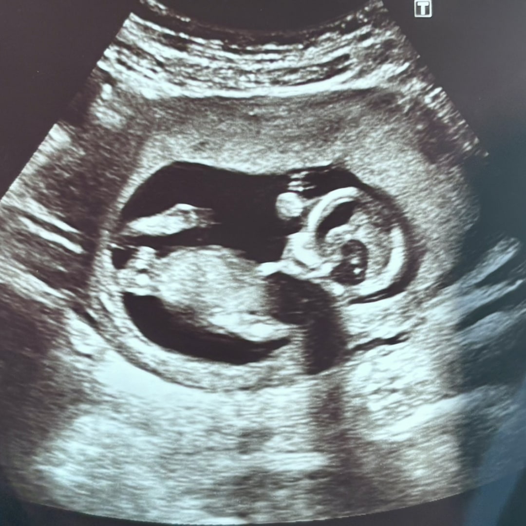 Photo shared by Trinity for their Babylist baby registry.