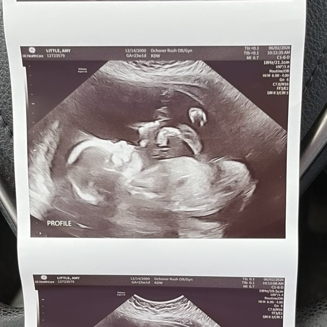 Photo shared by Amy for their Babylist baby registry.