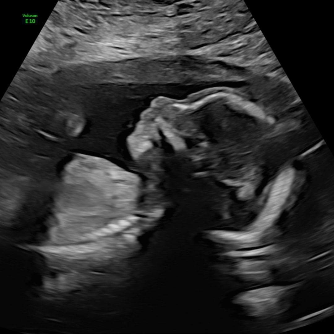 Photo shared by Marissa for their Babylist baby registry.