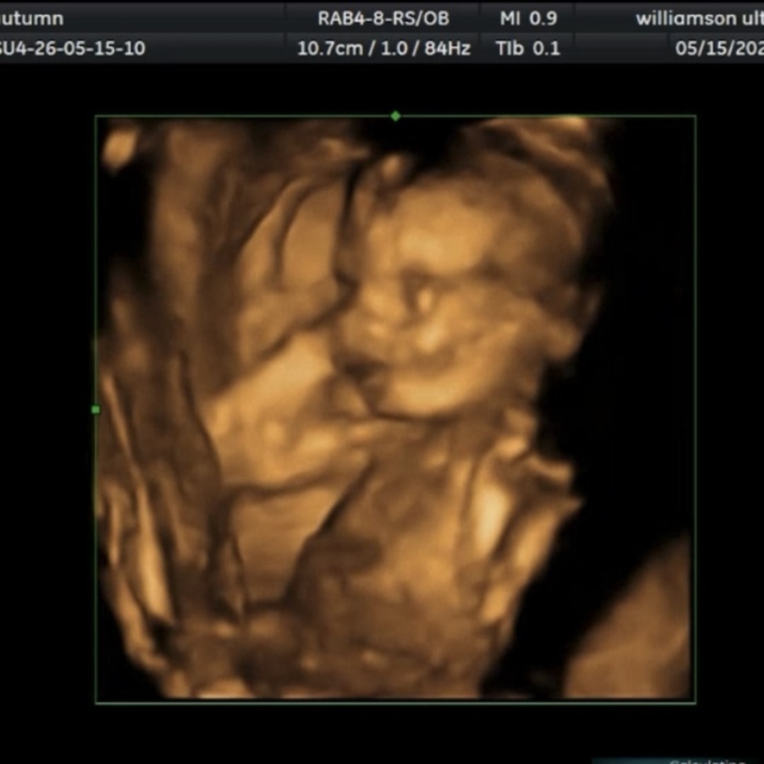Photo shared by Autumn for their Babylist baby registry.