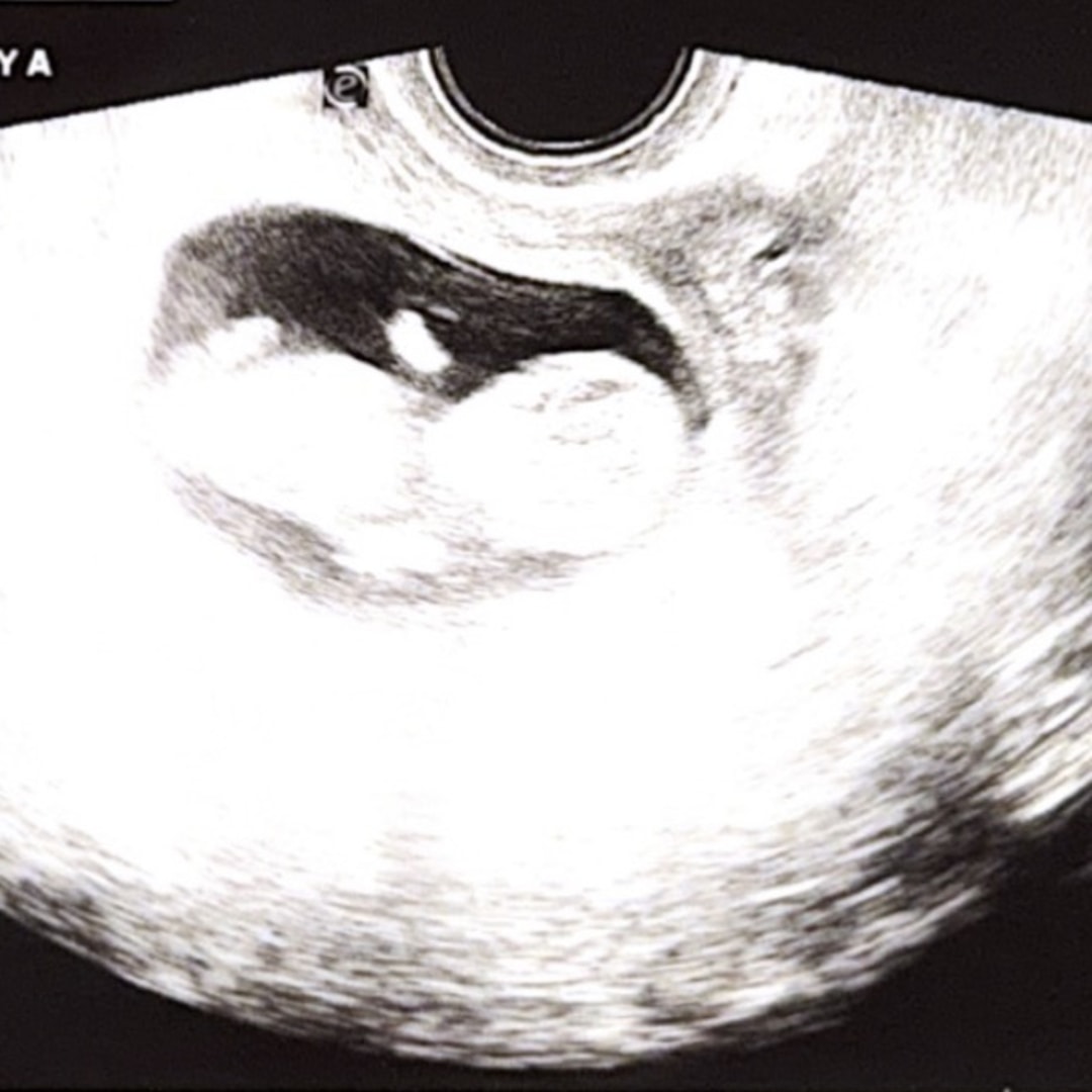 Photo shared by Bridget for their Babylist baby registry.