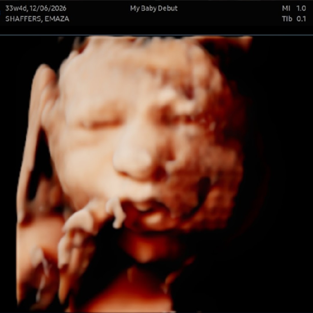 Photo shared by Emaza for their Babylist baby registry.