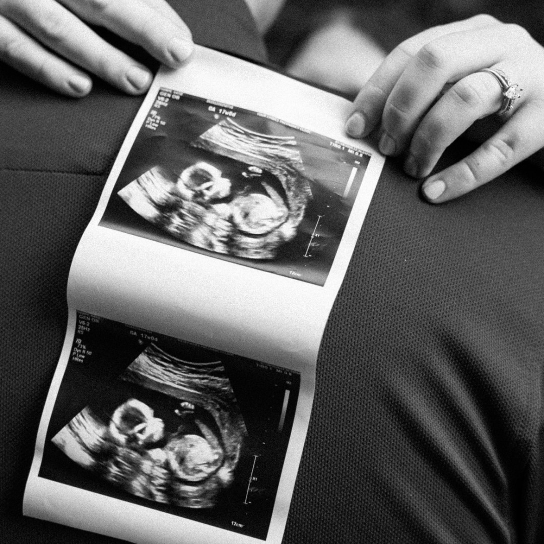 Photo shared by Katie for their Babylist baby registry.