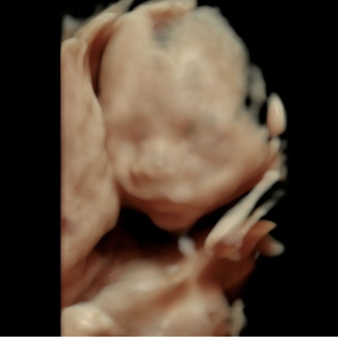 Photo shared by McKenna for their Babylist baby registry.