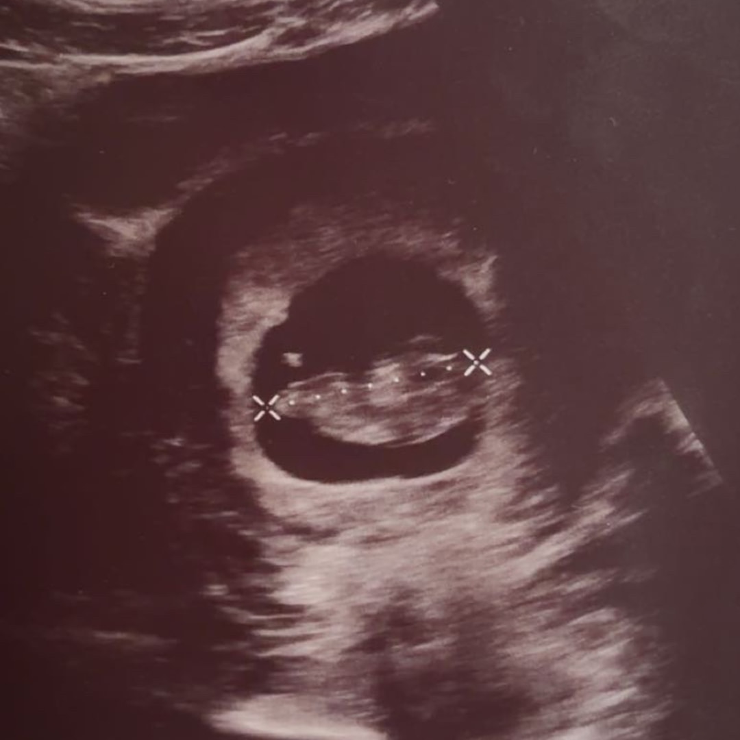 Photo shared by Kayla for their Babylist baby registry.