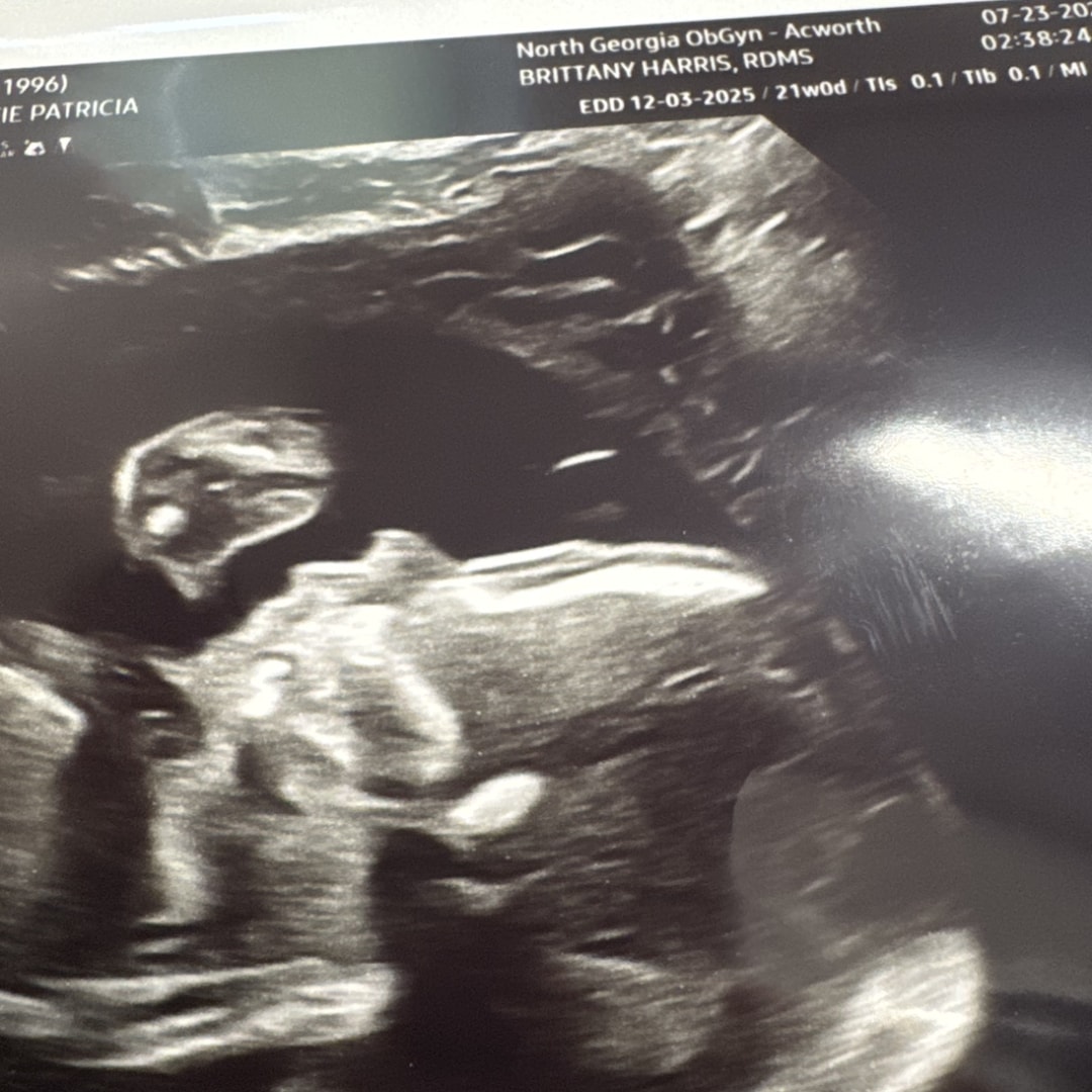 Photo shared by Katie for their Babylist baby registry.