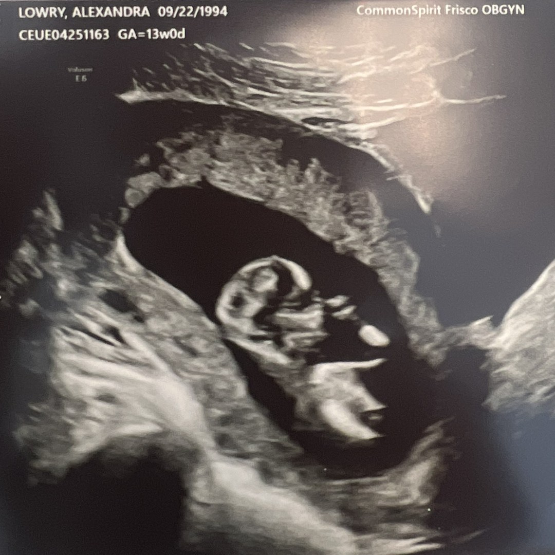 Photo shared by Alex for their Babylist baby registry.