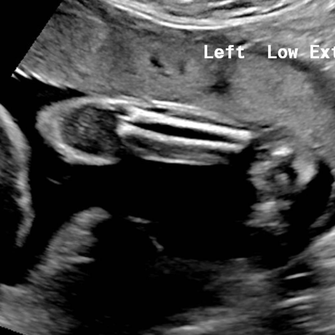 Photo shared by Samantha for their Babylist baby registry.