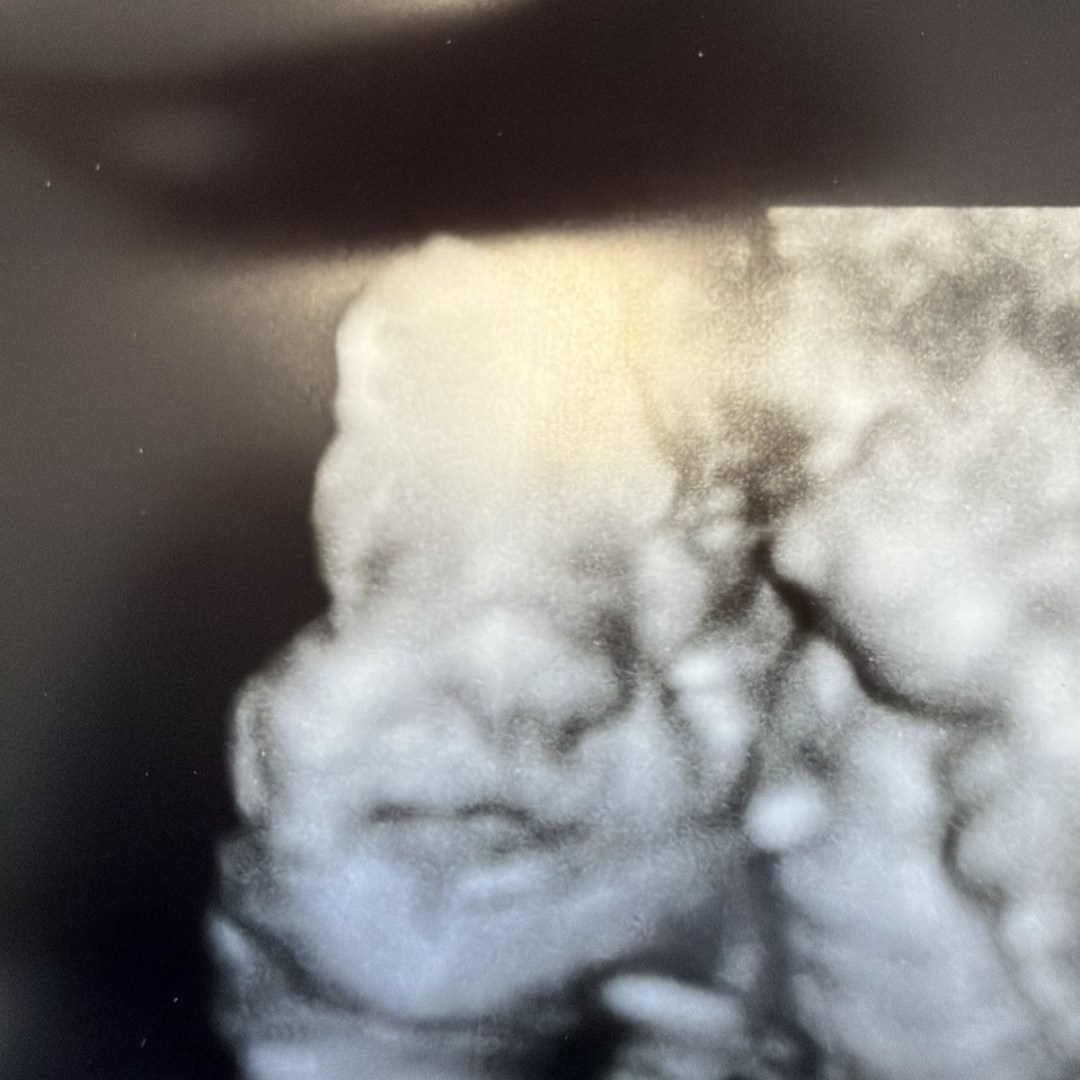 Photo shared by Jordan for their Babylist baby registry.