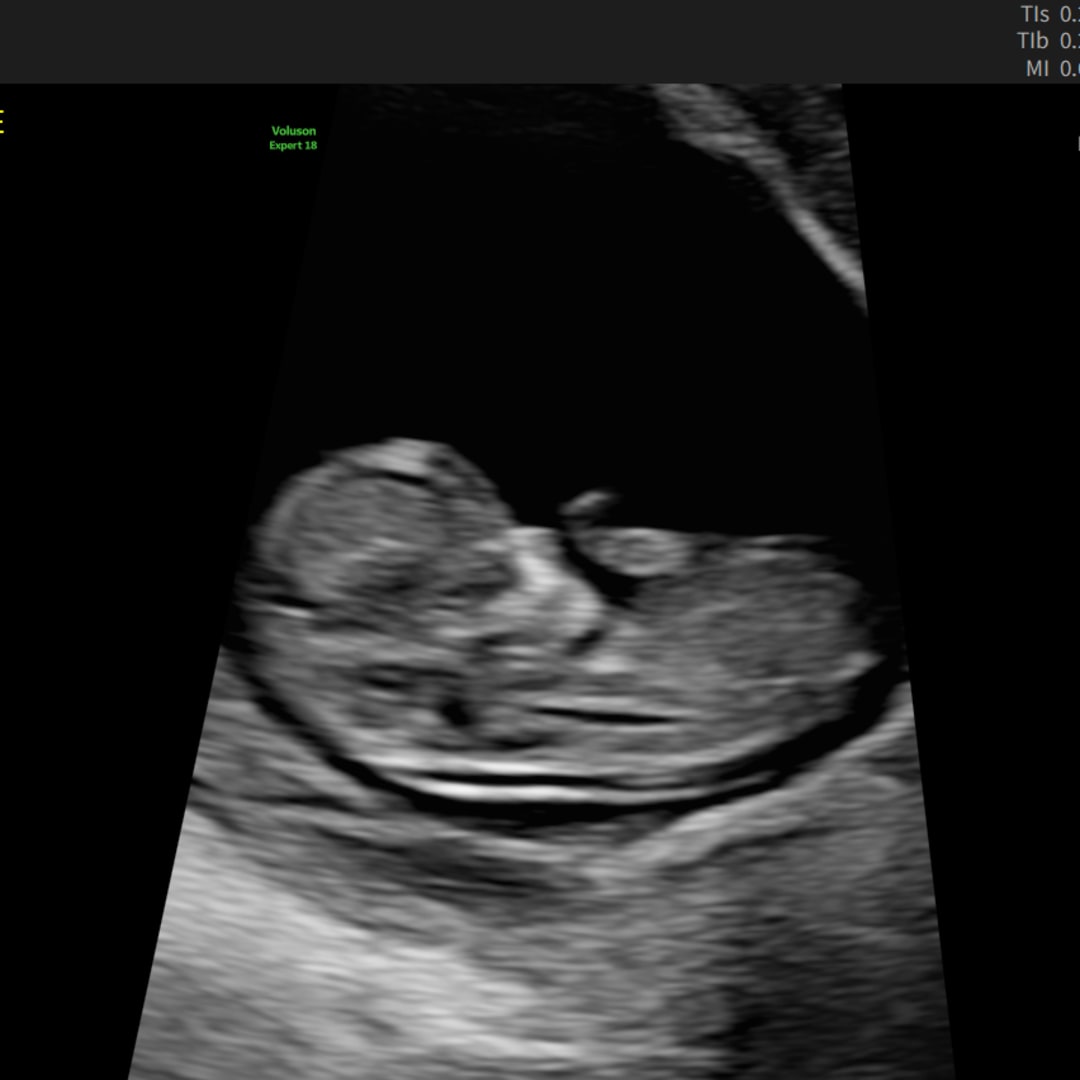 Photo shared by Anna & Drew for their Babylist baby registry.