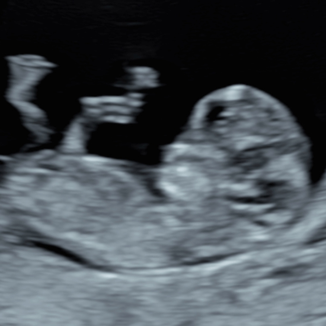 Photo shared by Uta for their Babylist baby registry.