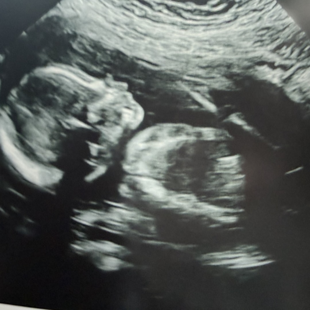 Photo shared by Emilee for their Babylist baby registry.