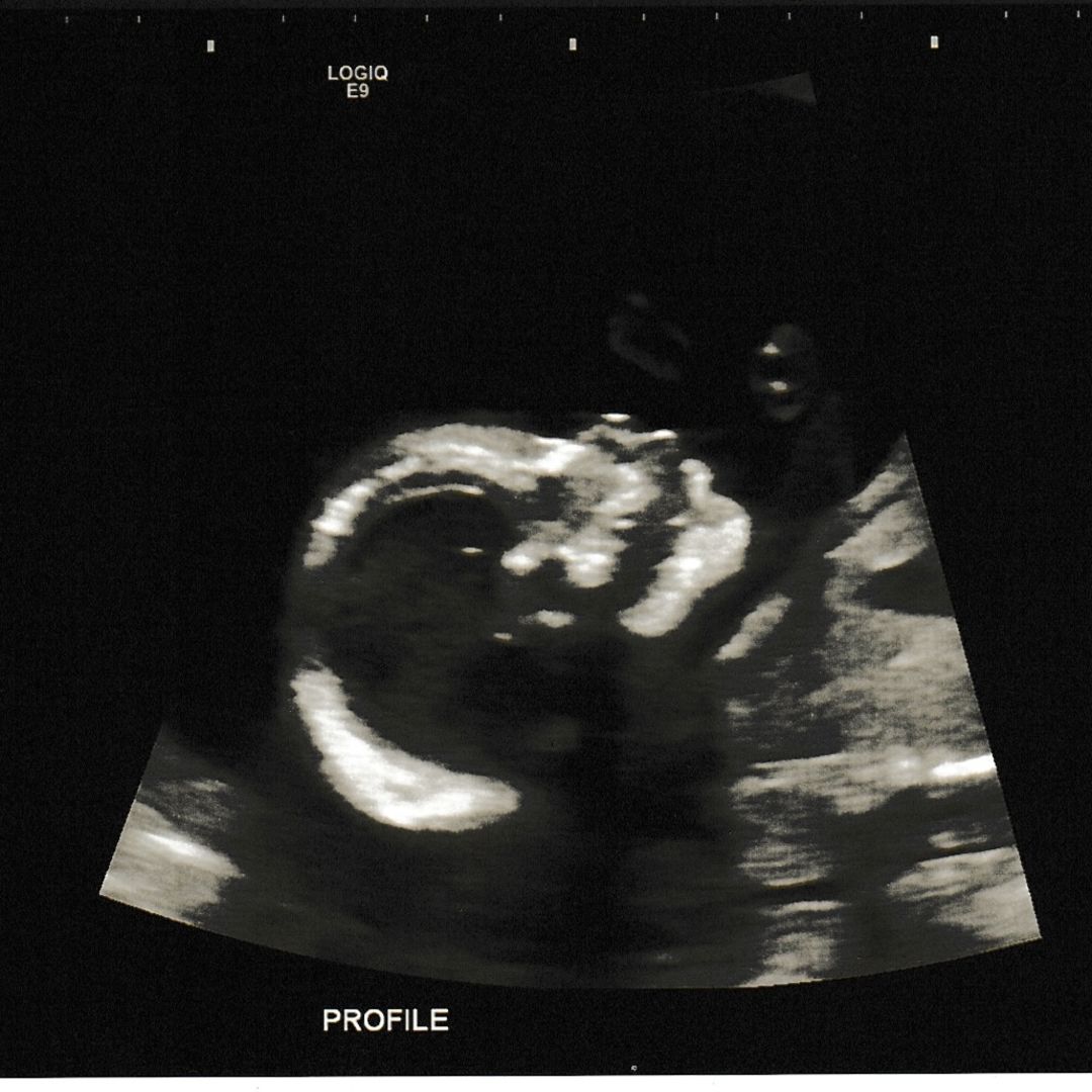 Photo shared by Larissa for their Babylist baby registry.