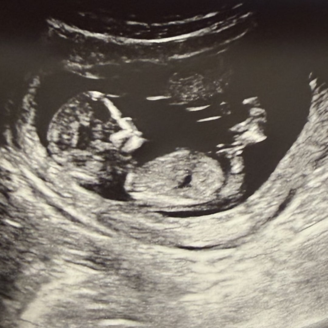 Photo shared by Alison for their Babylist baby registry.