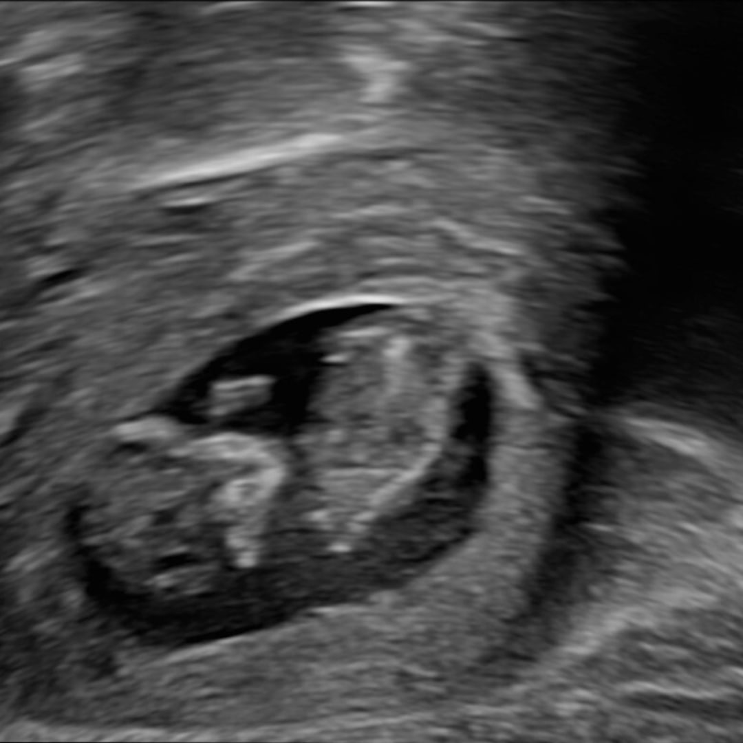 Photo shared by Katherine for their Babylist baby registry.