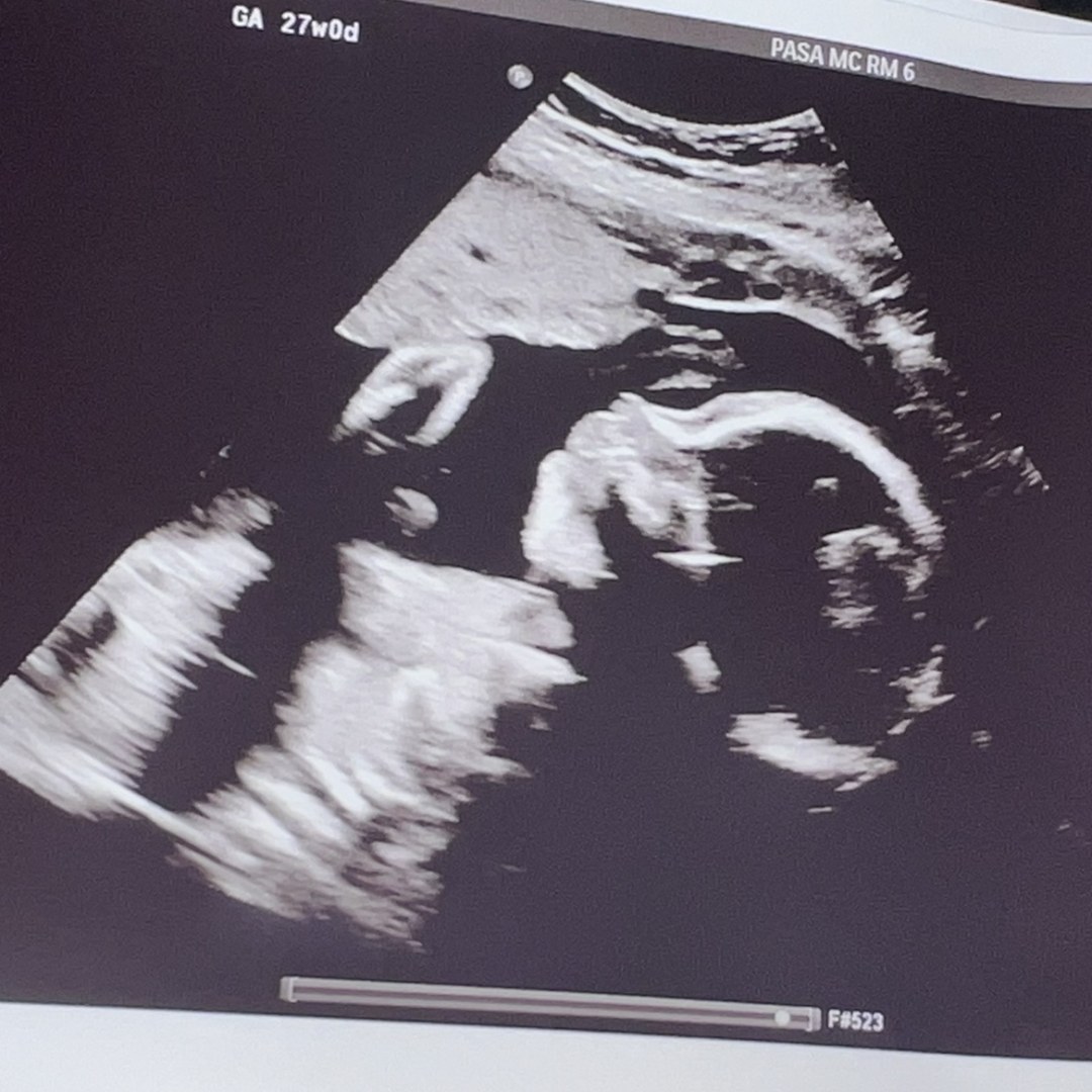 Photo shared by Jerilyn for their Babylist baby registry.