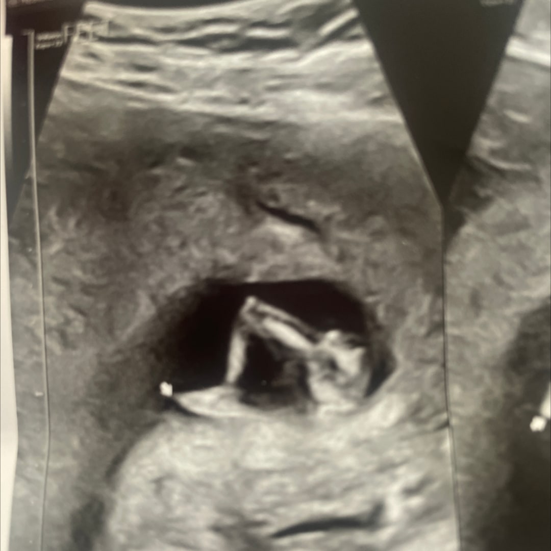 Photo shared by Danielle for their Babylist baby registry.