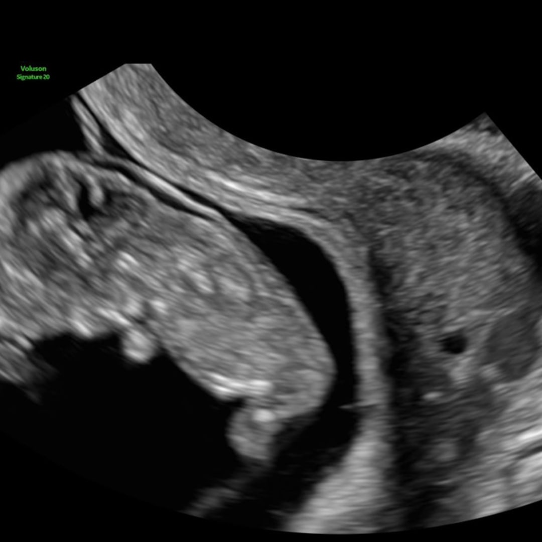 Photo shared by Meredythe for their Babylist baby registry.