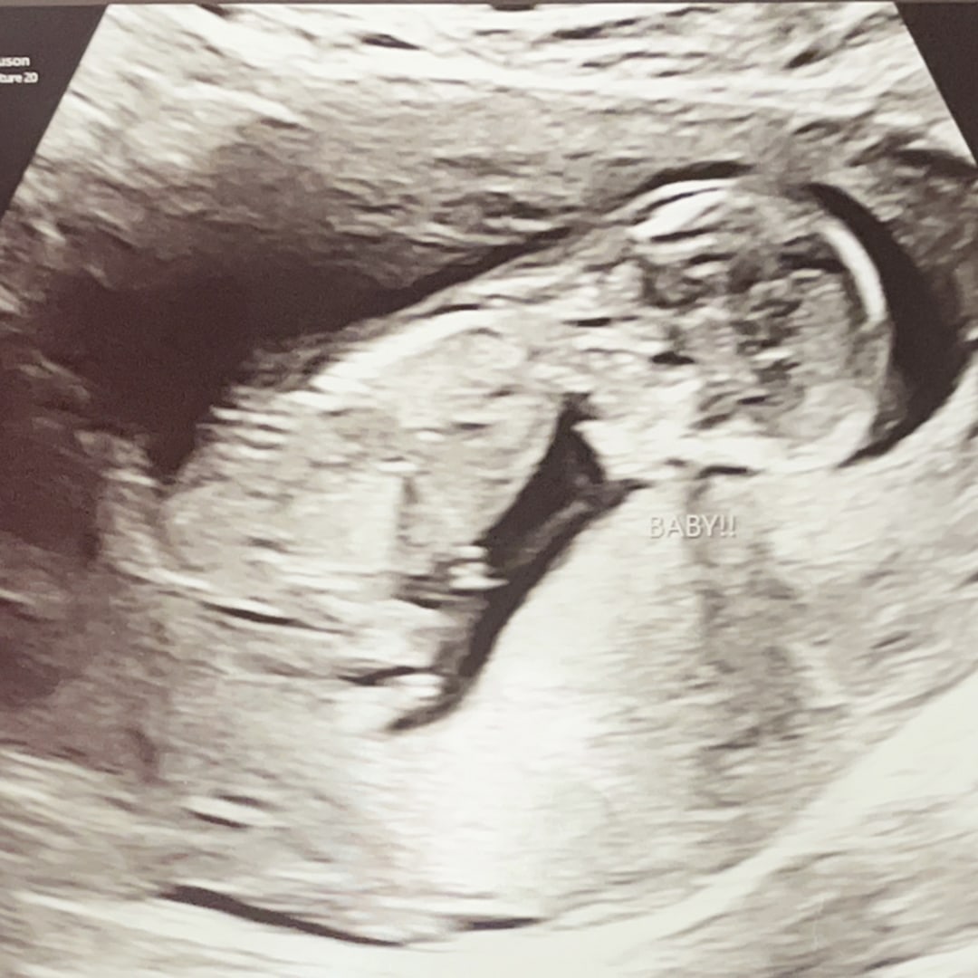 Photo shared by Dawn for their Babylist baby registry.