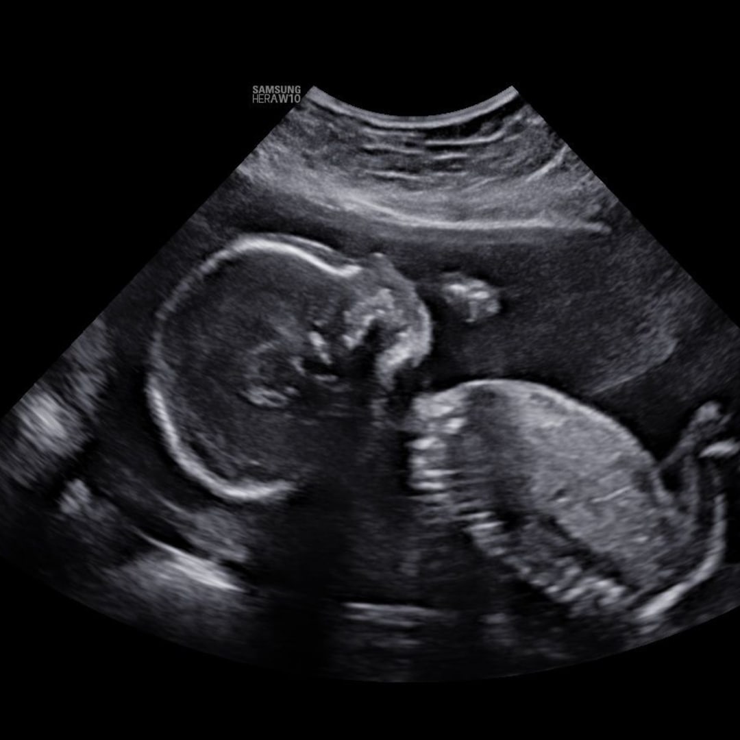 Photo shared by Jules for their Babylist baby registry.