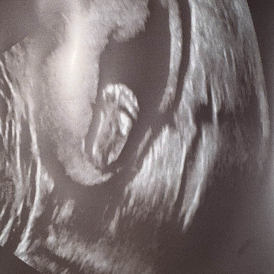 Photo shared by Joanna for their Babylist baby registry.