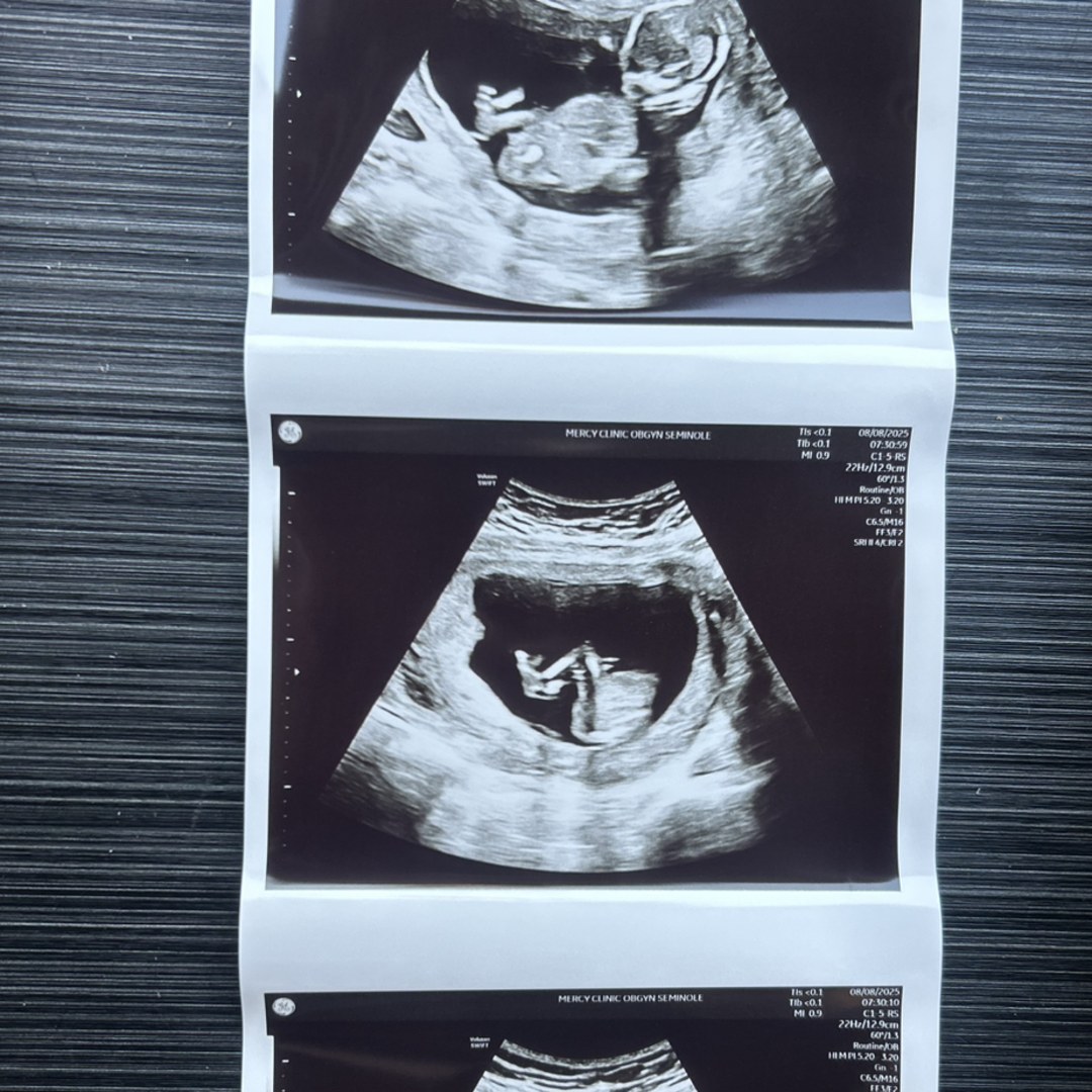 Photo shared by Eleanor for their Babylist baby registry.
