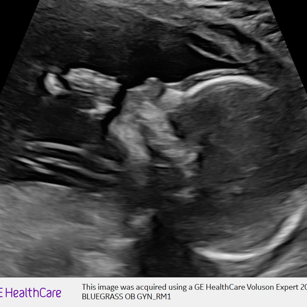 Photo shared by Symantha for their Babylist baby registry.