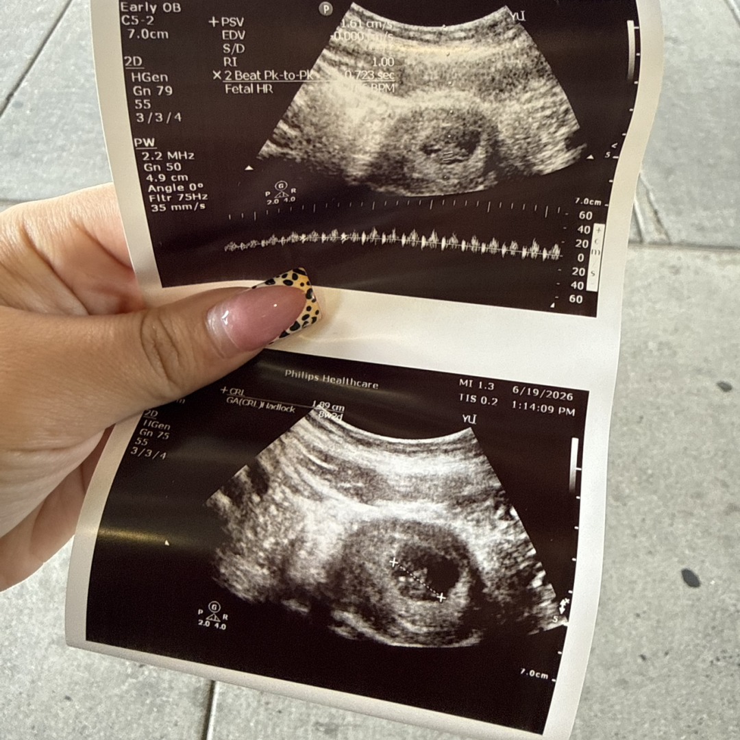 Photo shared by Alexandria for their Babylist baby registry.