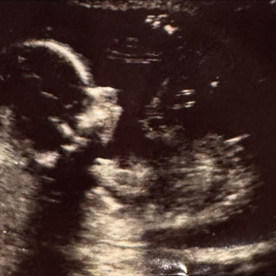 Photo shared by Sarah for their Babylist baby registry.