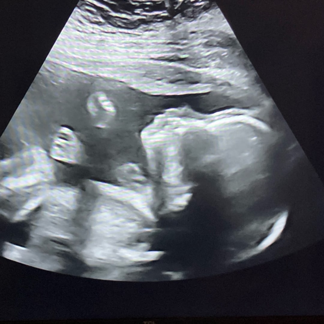 Photo shared by Hailey for their Babylist baby registry.