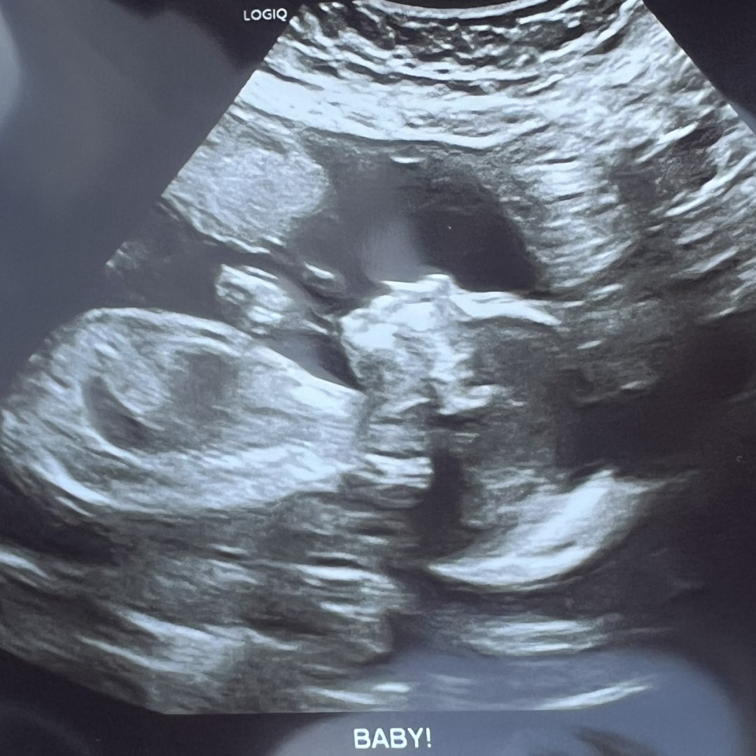 Photo shared by Marley for their Babylist baby registry.