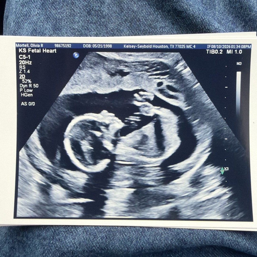 Photo shared by Olivia for their Babylist baby registry.