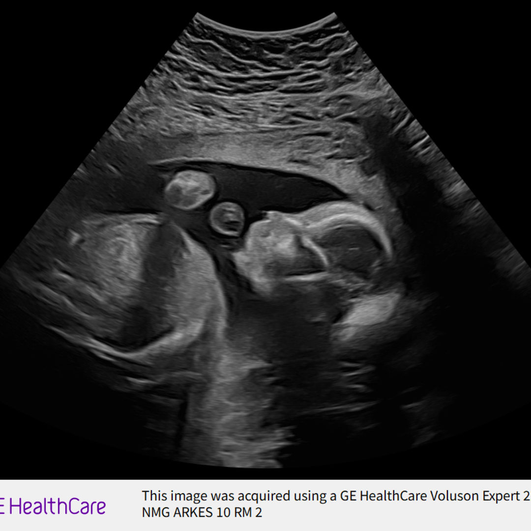 Photo shared by Rosalie for their Babylist baby registry.